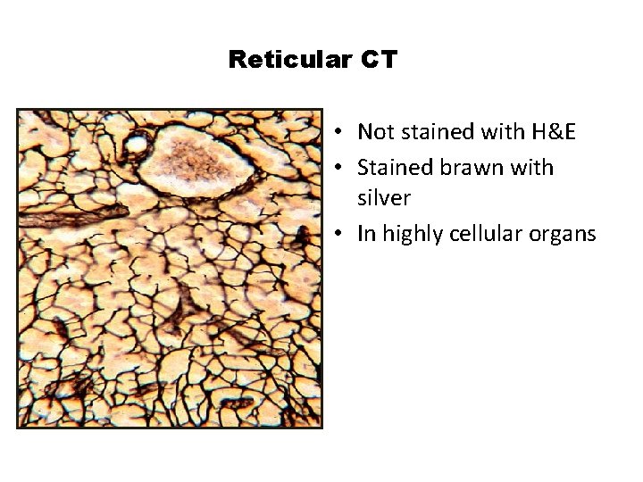 Reticular CT • Not stained with H&E • Stained brawn with silver • In