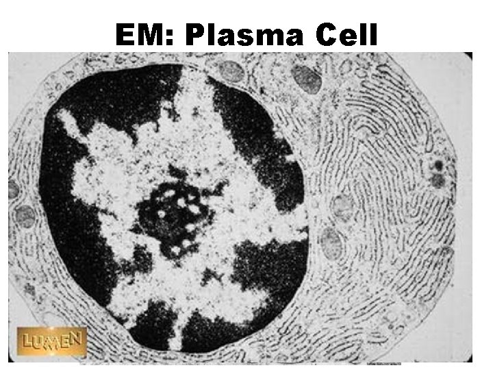 EM: Plasma Cell 