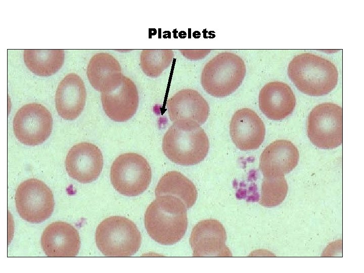 Platelets 