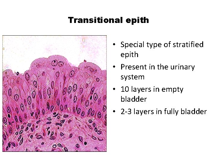 Transitional epith • Special type of stratified epith • Present in the urinary system