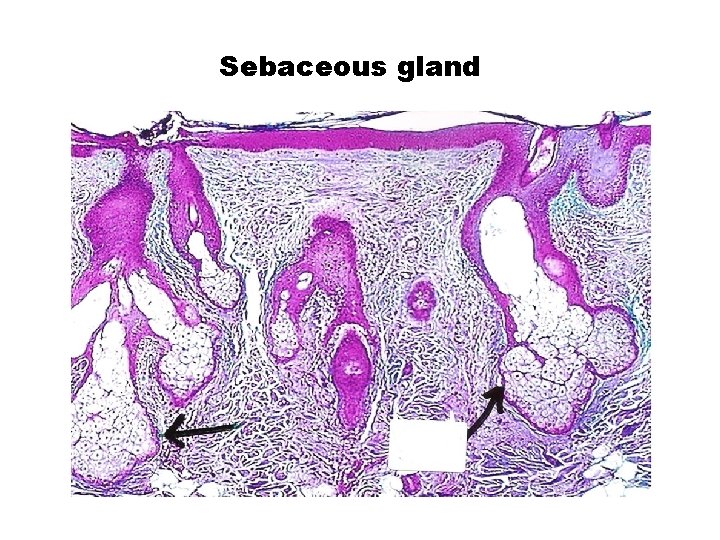 Sebaceous gland 