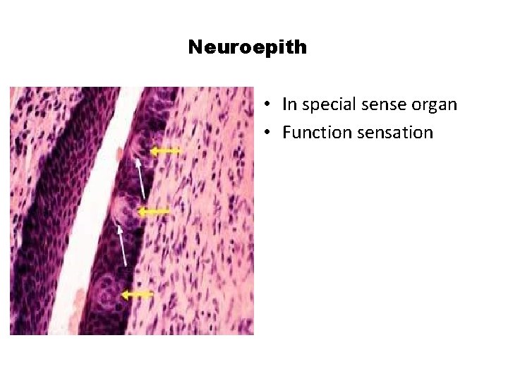 Neuroepith • In special sense organ • Function sensation 