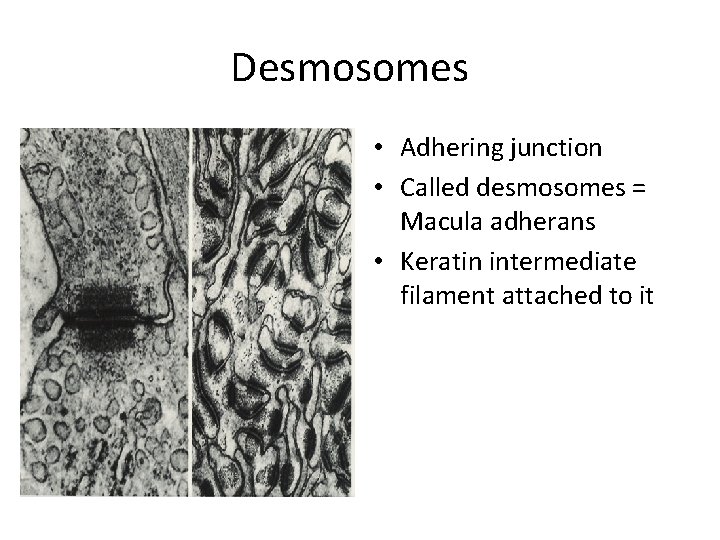 Desmosomes • Adhering junction • Called desmosomes = Macula adherans • Keratin intermediate filament