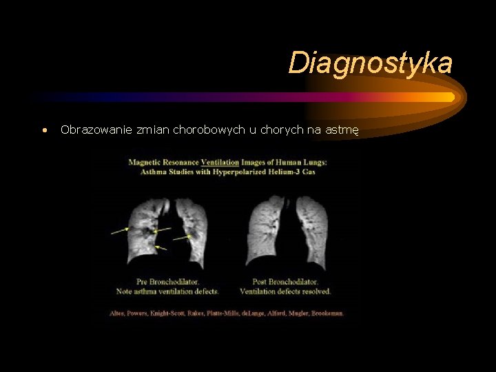 Diagnostyka • Obrazowanie zmian chorobowych u chorych na astmę 