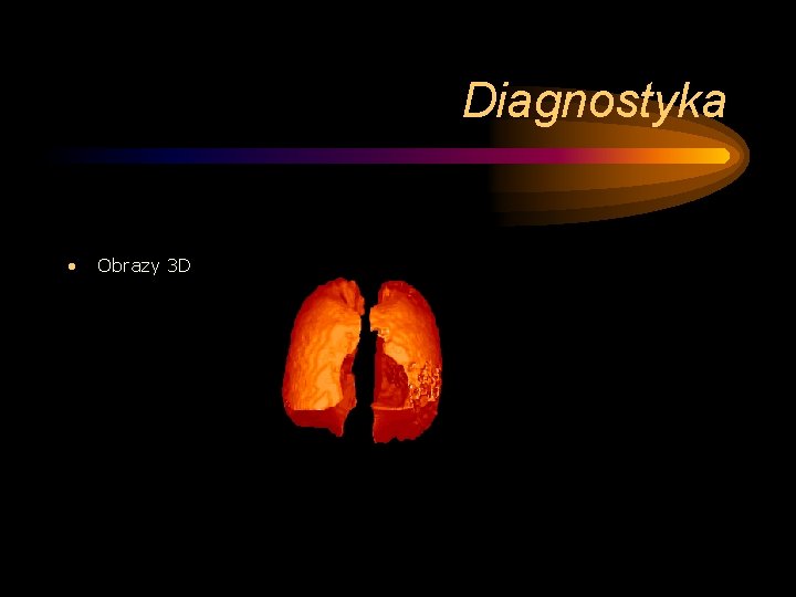 Diagnostyka • Obrazy 3 D 