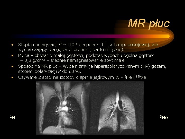 MR płuc • • 1 H Stopień polaryzacji P ~ 10 -6 dla pola