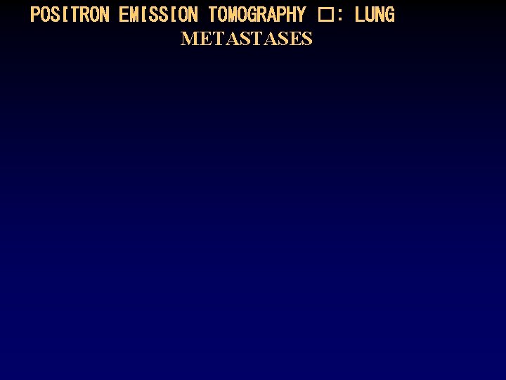 POSITRON EMISSION TOMOGRAPHY �: LUNG METASTASES 