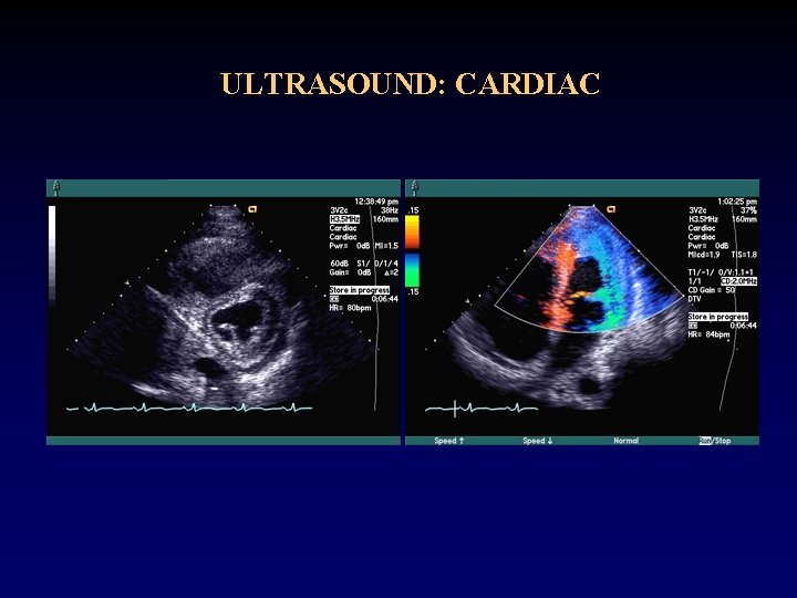 ULTRASOUND: CARDIAC 