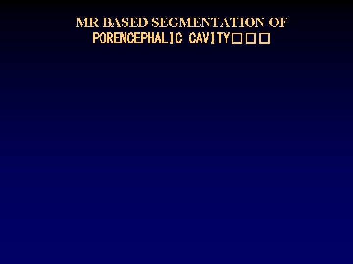 MR BASED SEGMENTATION OF PORENCEPHALIC CAVITY��� MR BASED SEGMENTATION OF PORENCEPHALIC CAVITY���