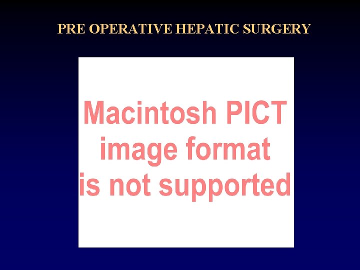 PRE OPERATIVE HEPATIC SURGERY 