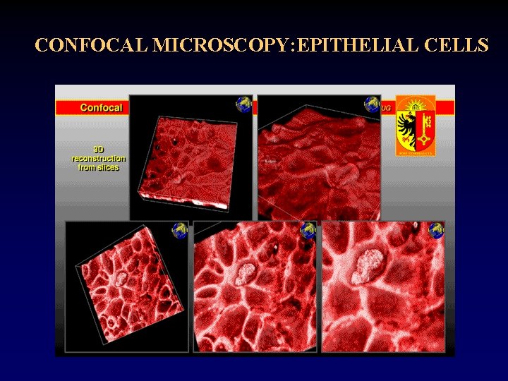 CONFOCAL MICROSCOPY: EPITHELIAL CELLS CONFOCAL MICROSCOPY: EPITHELIAL CELLS
