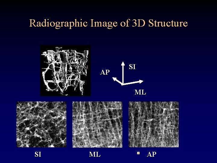 Radiographic Image of 3 D Structure AP SI ML AP 