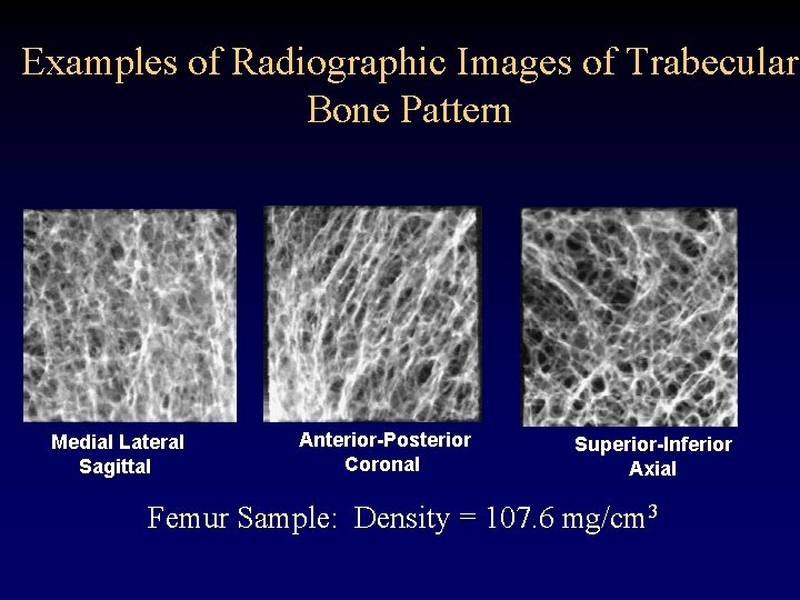 Examples of Radiographic Images of Trabecular Bone Pattern Medial Lateral Sagittal Anterior-Posterior Coronal Superior-Inferior