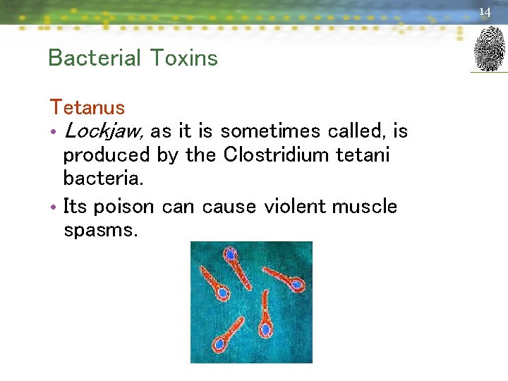 14 Bacterial Toxins Tetanus • Lockjaw, as it is sometimes called, is produced by