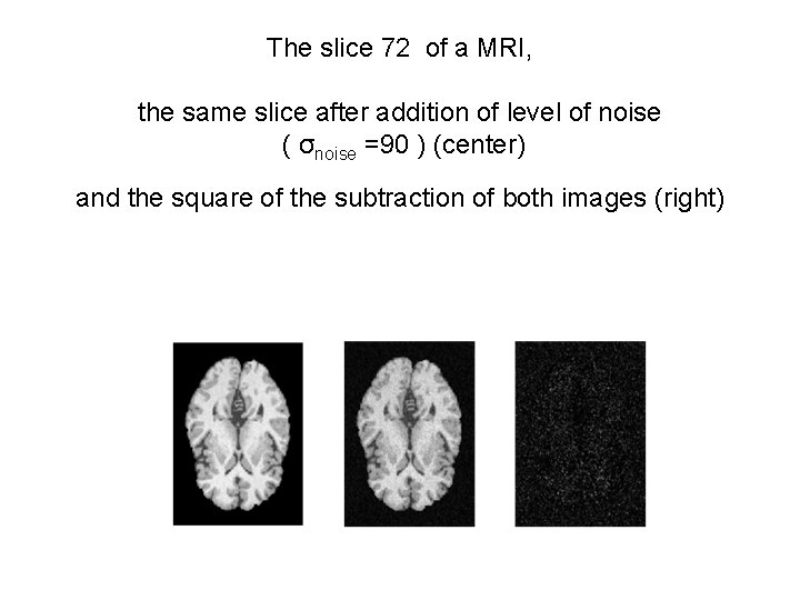 The slice 72 of a MRI, the same slice after addition of level of