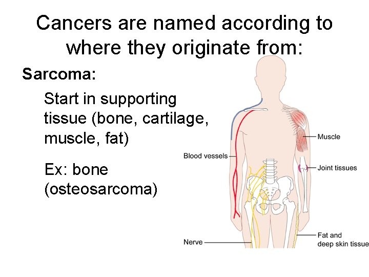 Cancers are named according to where they originate from: Sarcoma: Start in supporting tissue