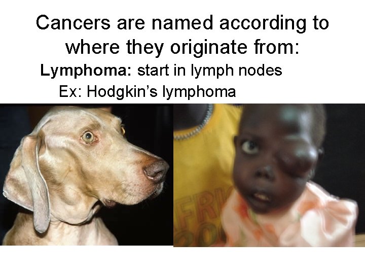 Cancers are named according to where they originate from: Lymphoma: start in lymph nodes