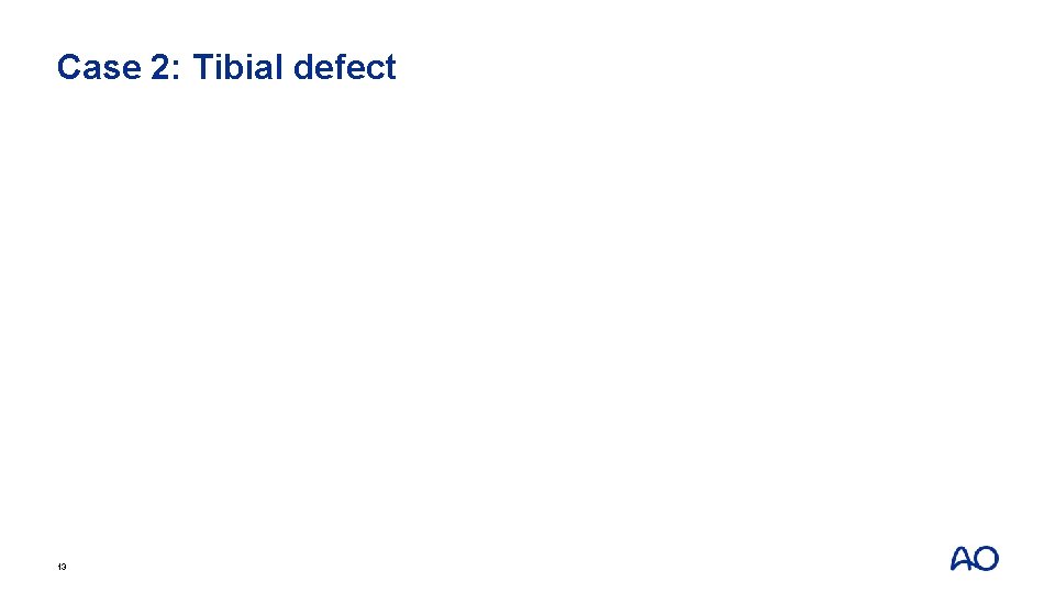 Case 2: Tibial defect 13 