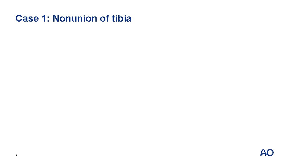 Case 1: Nonunion of tibia 2 