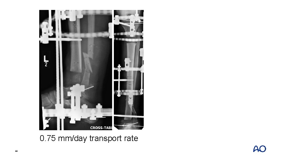 0. 75 mm/day transport rate 44 