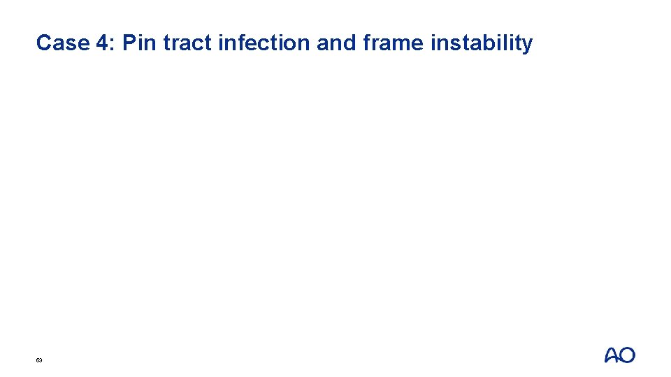 Case 4: Pin tract infection and frame instability 53 