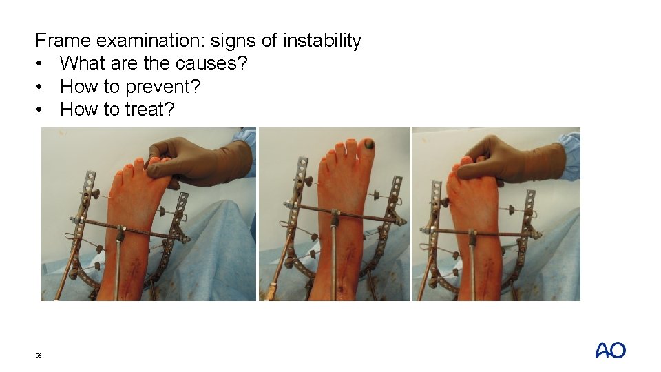 Frame examination: signs of instability • What are the causes? • How to prevent?