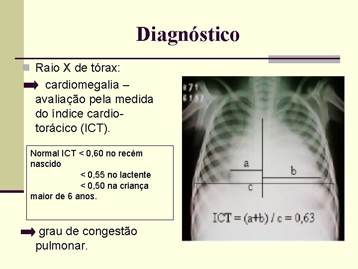 Diagnóstico n Raio X de tórax: cardiomegalia – avaliação pela medida do índice cardiotorácico