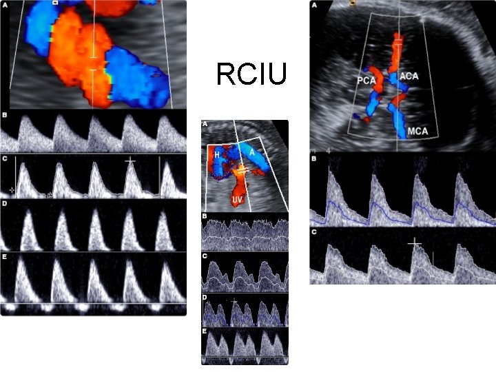 RCIU 