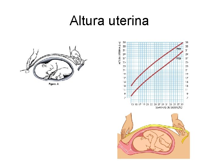 Altura uterina 
