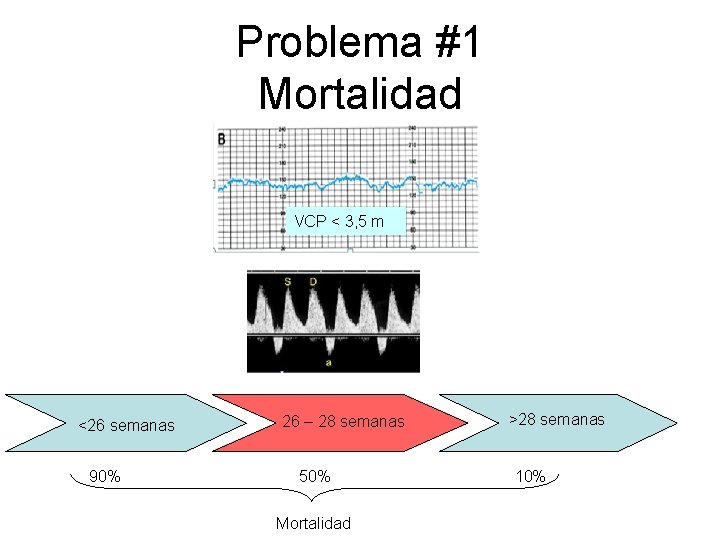 Problema #1 Mortalidad VCP < 3, 5 m <26 semanas 90% 26 – 28