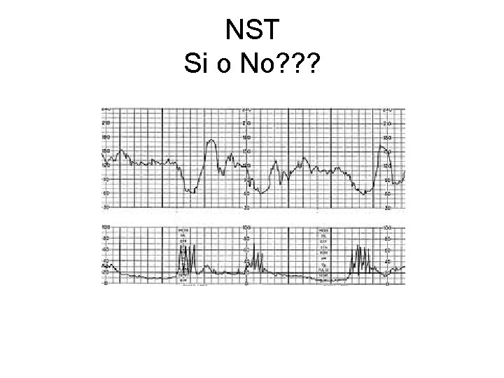 NST Si o No? ? ? 