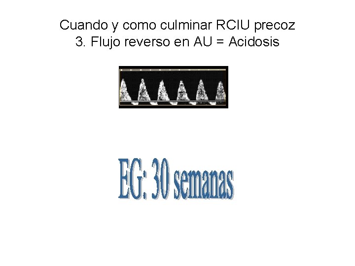 Cuando y como culminar RCIU precoz 3. Flujo reverso en AU = Acidosis 