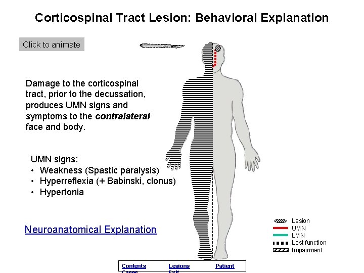 Corticospinal Tract Lesion: Behavioral Explanation Click to animate Damage to the corticospinal tract, prior