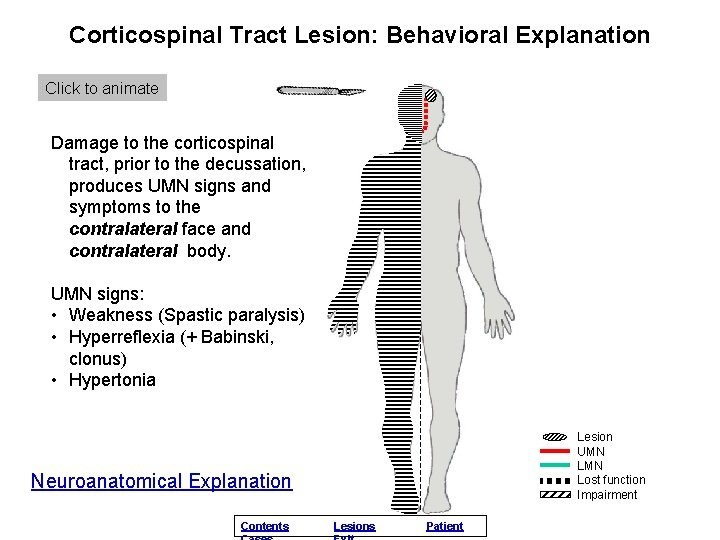 Corticospinal Tract Lesion: Behavioral Explanation Click to animate Damage to the corticospinal tract, prior