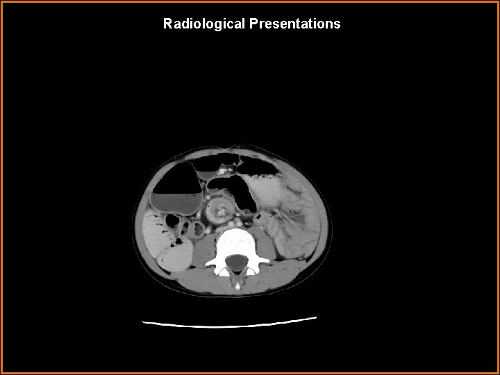 Radiological Presentations 