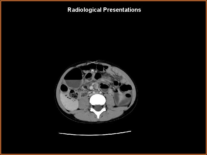 Radiological Presentations 