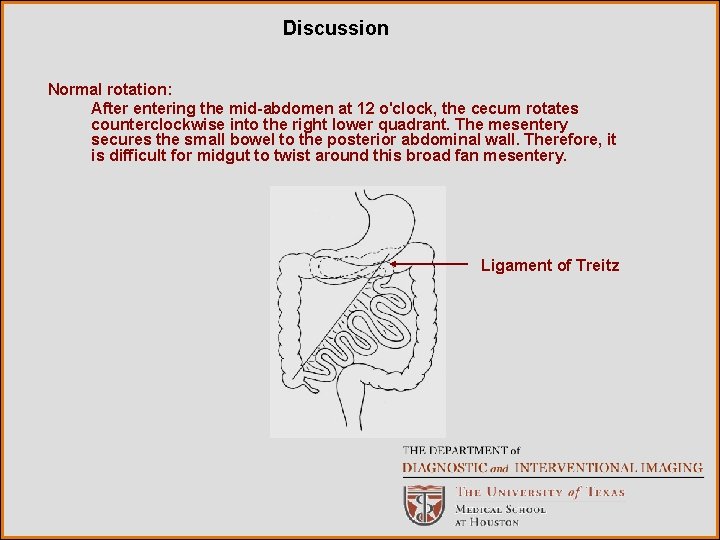 Discussion Normal rotation: After entering the mid-abdomen at 12 o'clock, the cecum rotates counterclockwise