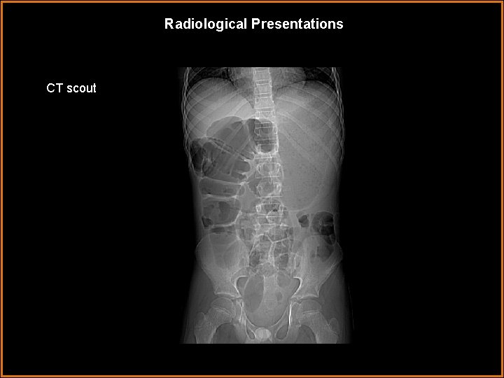 Radiological Presentations CT scout 