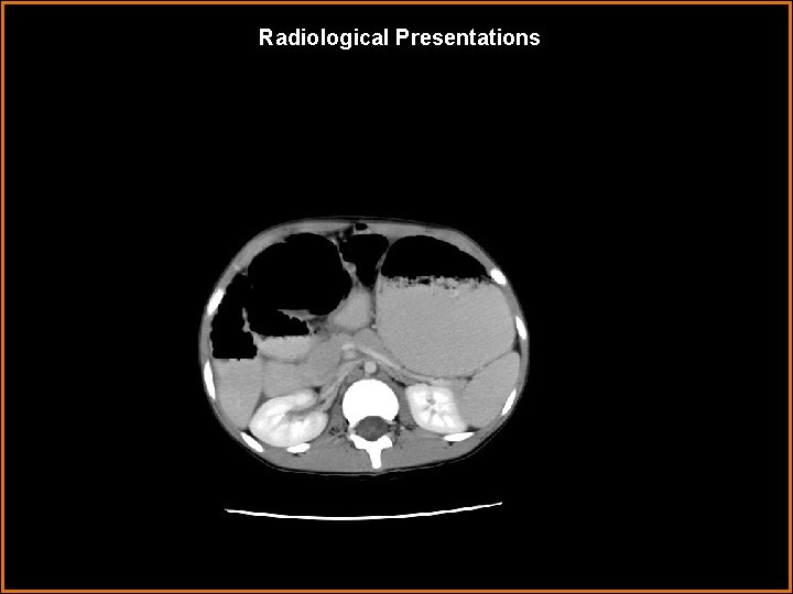 Radiological Presentations 