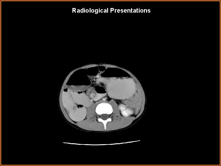 Radiological Presentations 