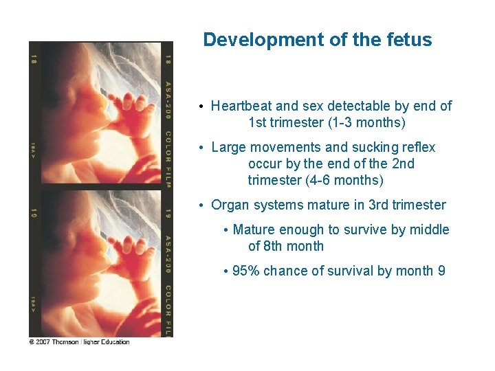 Development of the fetus • Heartbeat and sex detectable by end of 1 st