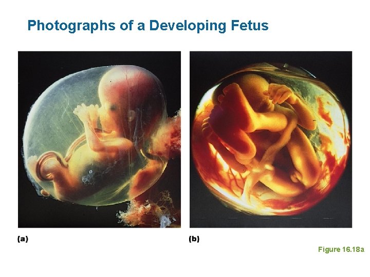 Photographs of a Developing Fetus Figure 16. 18 a 
