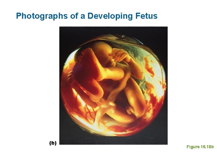 Photographs of a Developing Fetus Figure 16. 18 b 