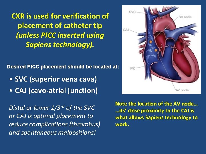 CXR is used for verification of placement of catheter tip (unless PICC inserted using