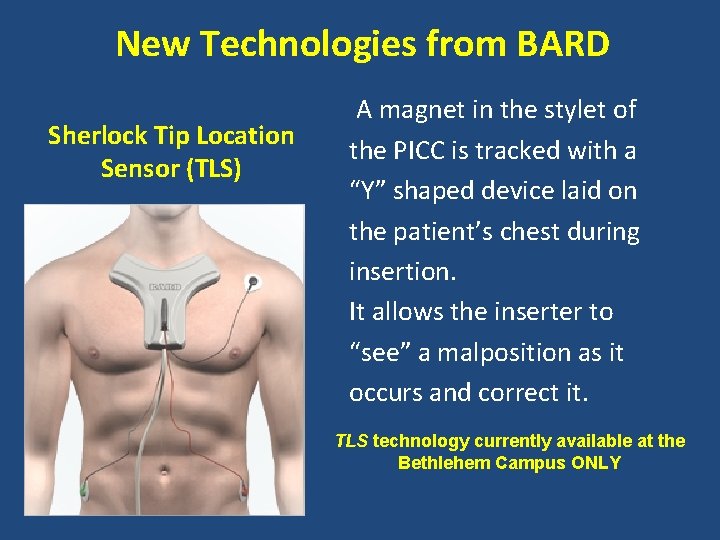 New Technologies from BARD Sherlock Tip Location Sensor (TLS) A magnet in the stylet