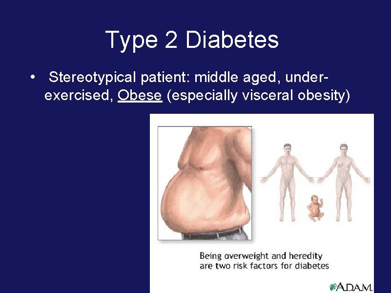 Type 2 Diabetes • Stereotypical patient: middle aged, underexercised, Obese (especially visceral obesity) 