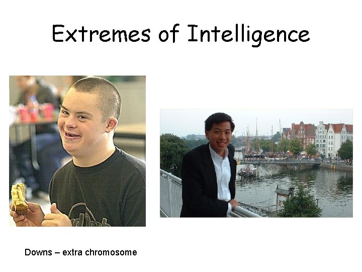 Extremes of Intelligence Downs – extra chromosome 