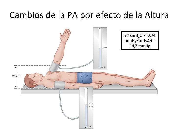 Cambios de la PA por efecto de la Altura 20 cm. H 2 O