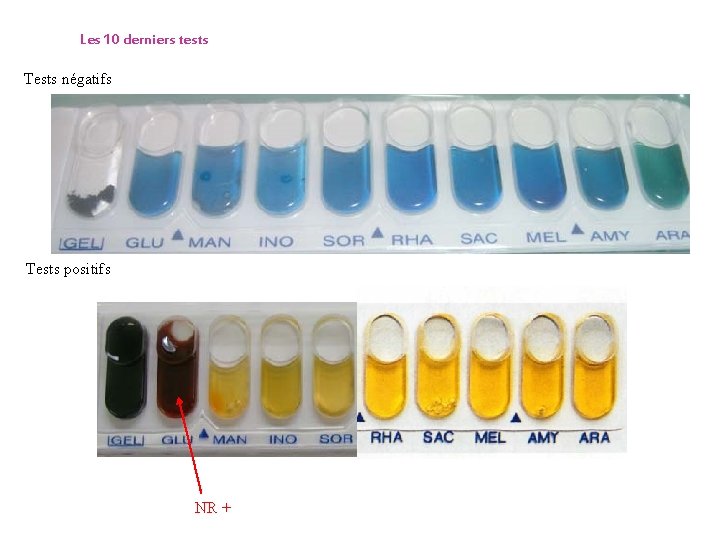 Les 10 derniers tests Tests négatifs Tests positifs NR + 