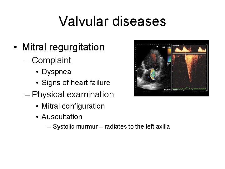 Valvular diseases • Mitral regurgitation – Complaint • Dyspnea • Signs of heart failure Valvular diseases • Mitral regurgitation – Complaint • Dyspnea • Signs of heart failure